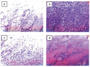 Histological proliferation and infiltration of the leucocytes to the join tissues of rat paw.