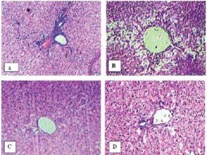 Effect of CDEE (400 mg/kg) and silymarin (100 mg/kg) on liver histopathology of CCl4 treated male wistar rats.